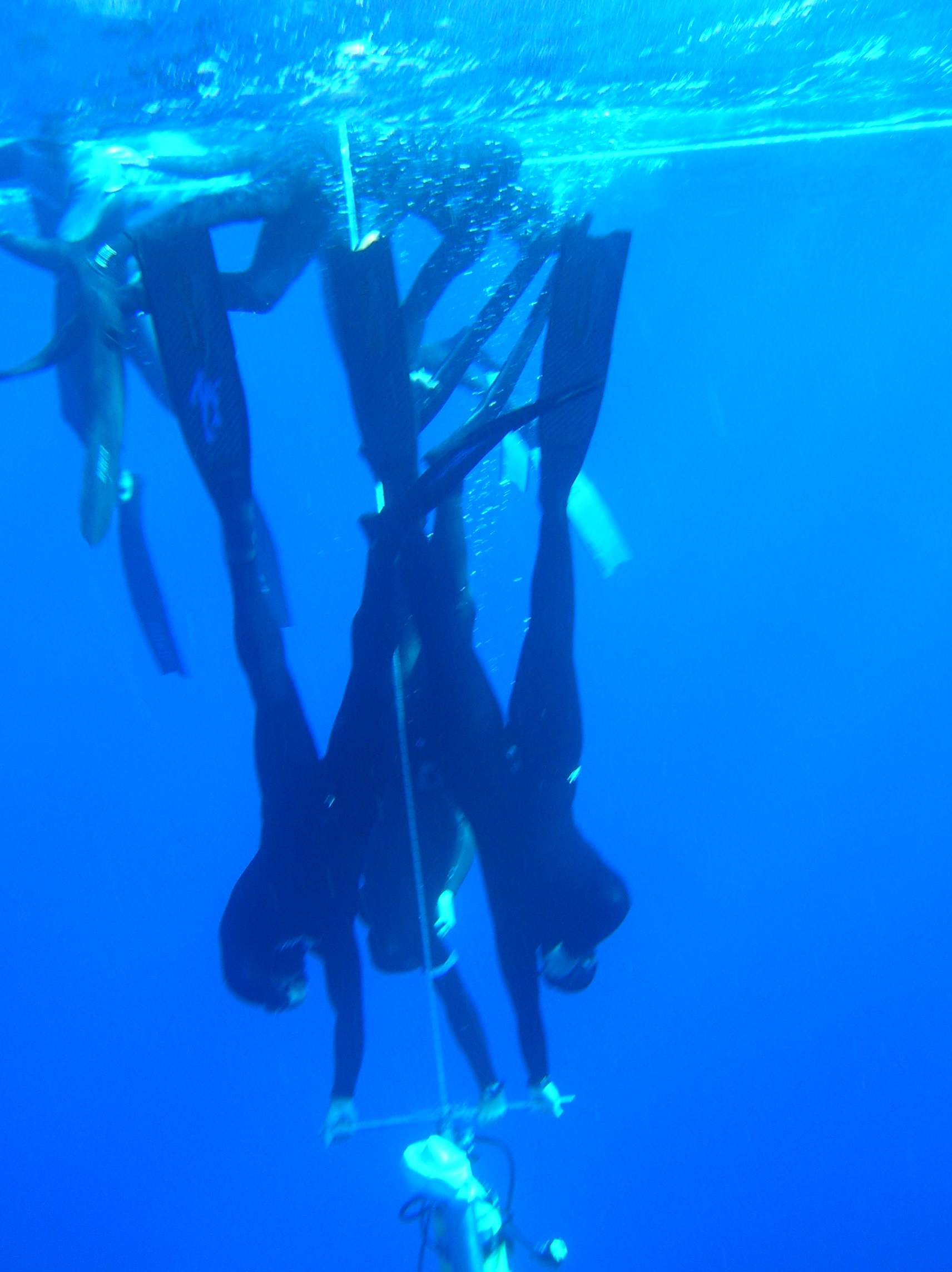 apnea